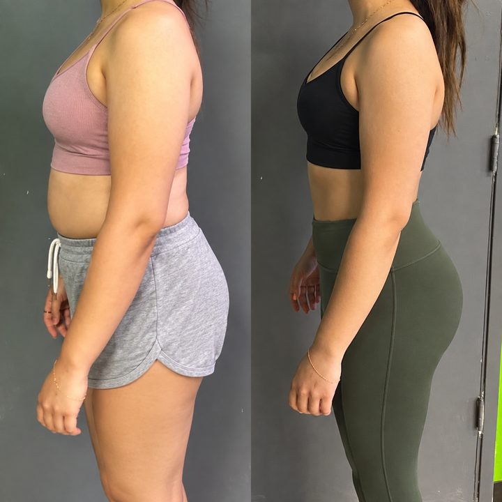 Before and after 2