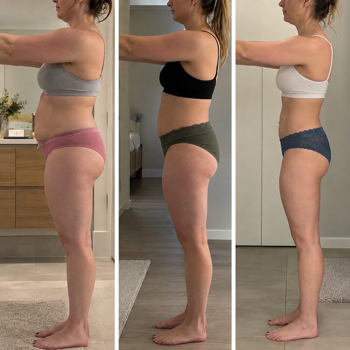 Before and after 4